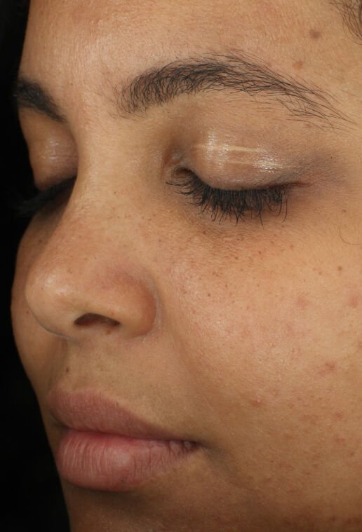 Complexion Clarifying Serum